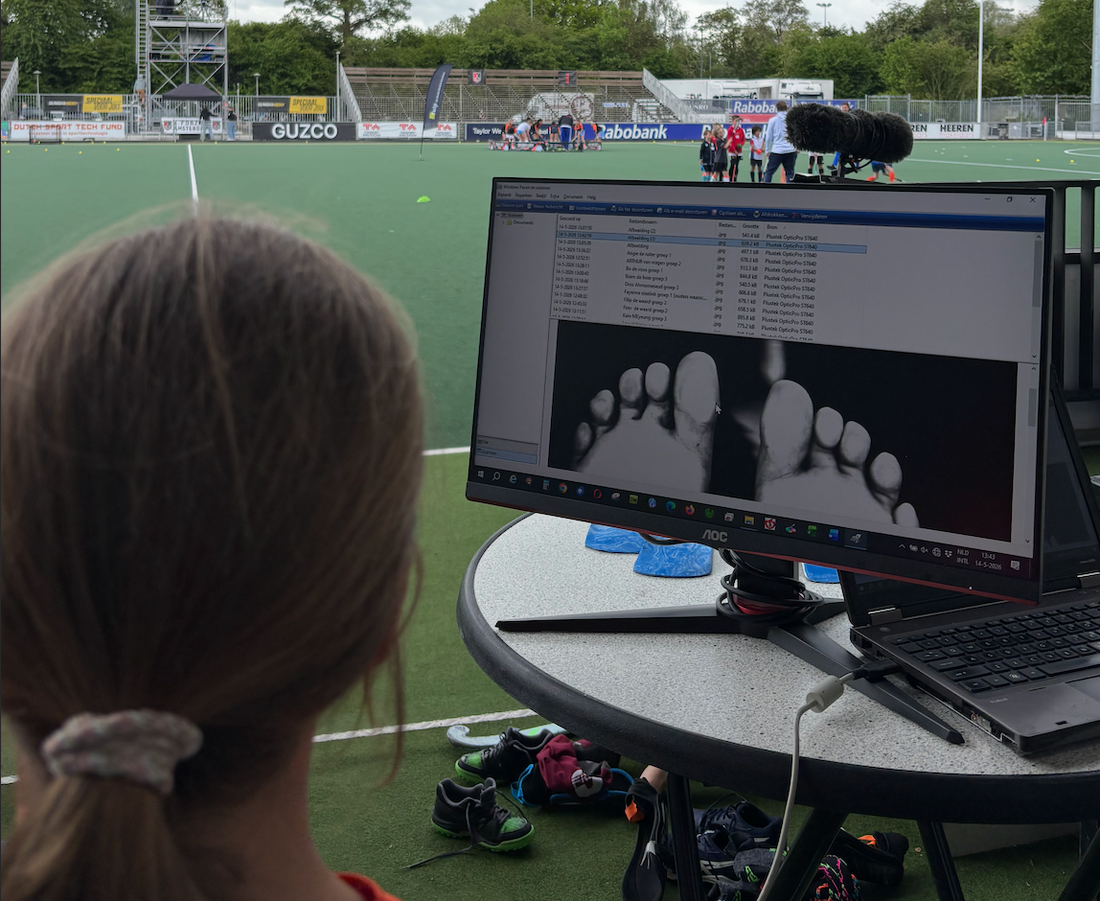 Topsport begint bij de basis: je voeten